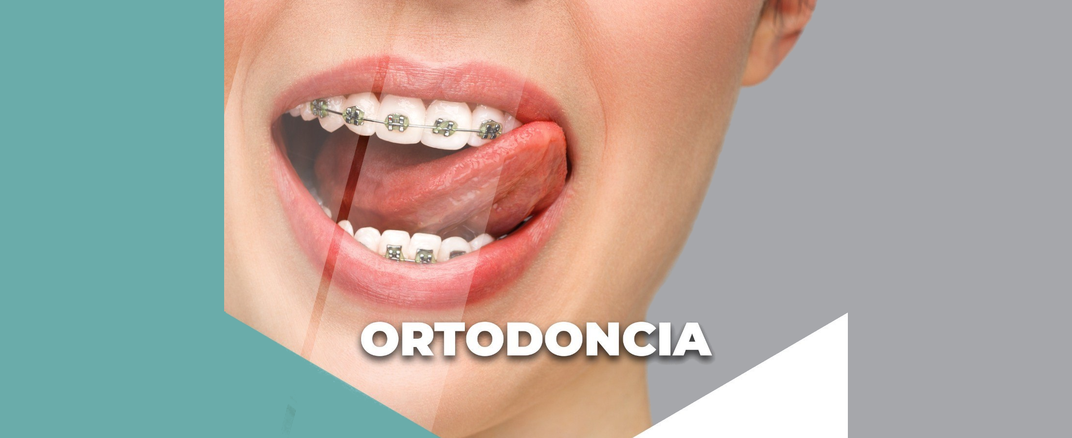 ortodonciaa